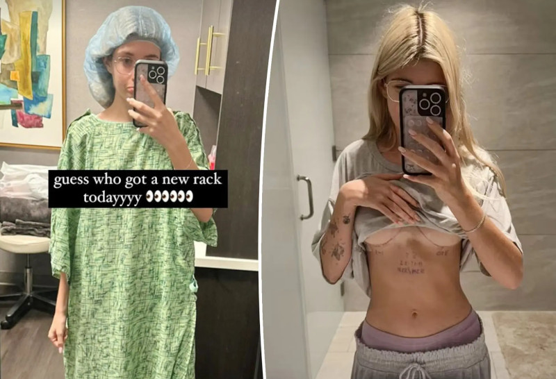 Fox News: 19-летняя дочь Чарли Шина хочет поменять грудные имплантаты на более крупные